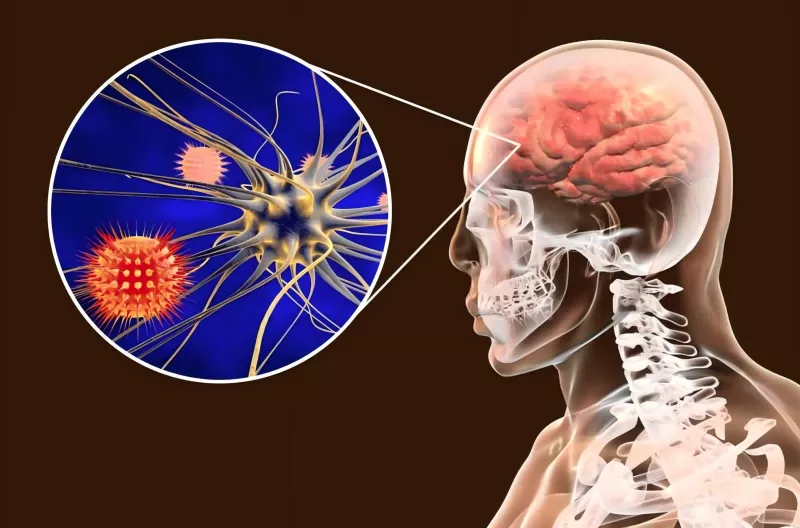 Guide du vaccin contre le méningocoque Guide du vaccin contre le méningocoque